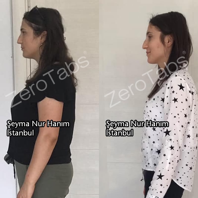 ZERO